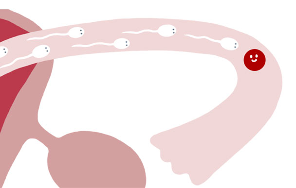 5：卵管に到着し、精子と卵子が出会う