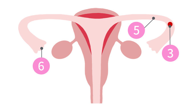 4：卵子は卵管の中で精子を待つ