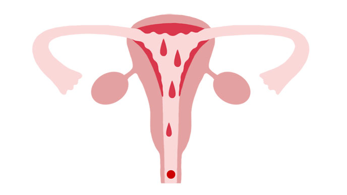 6：子宮内膜がはがれてからだの外へ